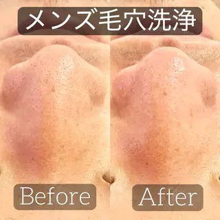 アイラッシュ&エステサロンLinda西宮所属・小顔&毛穴・肌質改善 LINDA西宮 AIのエステ・リラクイメージ