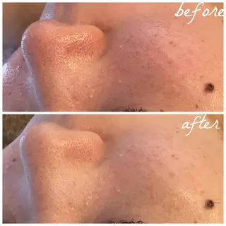 メンズ メナード岐阜市茜部 杉浦のエステ・リラクイメージ