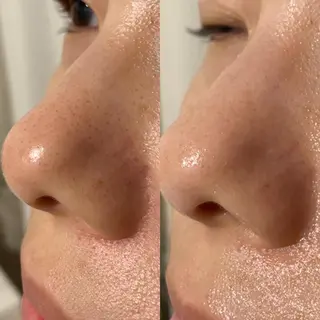 よもぎ蒸し専門店Artemisia所属・よもぎ蒸し専門店 Artemisiaのエステ・リラクイメージ