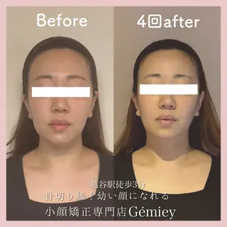 小顔矯正専門店Gémiey所属・越谷駅徒歩３分 小顔専門Gemieyのエステ・リラクイメージ
