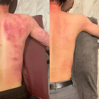 セルフエステエンリケ明石大久保店所属・夕希リンパ&痩身& 脱毛&毛穴ケアのエステ・リラクイメージ