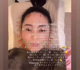 THE  ROOTS所属・美容鍼♡小顔矯正♡ fumikaのエステ・リラクイメージ