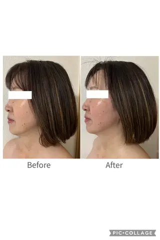 la lumie're (ラ リュミエール)所属・小顔サロン (ラ リュミエール)のエステ・リラクイメージ