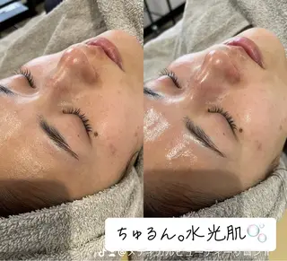 メディカルエステサロンir アイアール所属・韓国肌管理　肌質改善 irのエステ・リラクイメージ