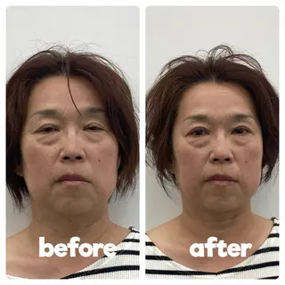 美容鍼灸整体サロンCHARMEB【シャルム】所属・馬場 武のエステ・リラクイメージ