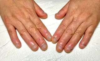 ネイル 深爪・自爪育成専門 MAHALOHIのネイルデザイン