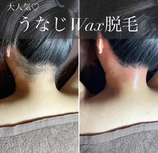 エピナス町田店 ブラジリアンワックスのエステ・リラクイメージ