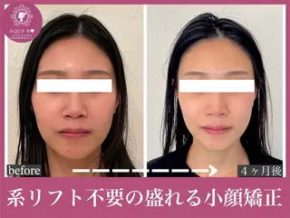 盛れる小顔矯正師 たく先生のエステ・リラクイメージ