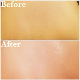 B.GLAM シュガーリング渋谷のエステ・リラクイメージ