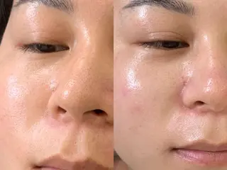 ネイル aliaハイフ&水光ジェットサロン所属・aliaハーブ水光店 エステティシャン募集のエステ・リラクイメージ