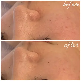 メンズ メナード岐阜市茜部 杉浦のエステ・リラクイメージ