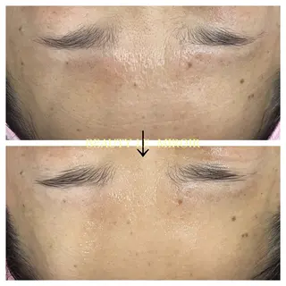 ビューティー ミロワールのエステ・リラクイメージ