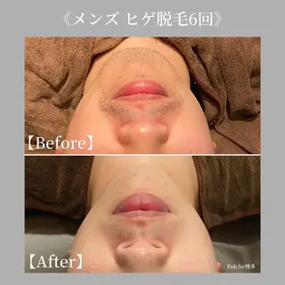 Folche博多店所属・folche博多 NAMIのエステ・リラクイメージ