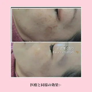 パーソナルカラー・骨格/顔診断【eternity】所属・【トータル美容】 Eternityのその他イメージ