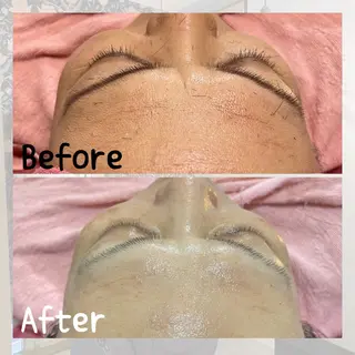 hair make echo所属・hair make echo 大橋亜弥のエステ・リラクイメージ