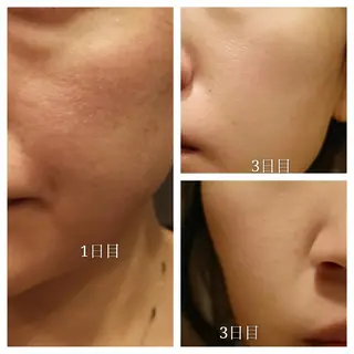 🅖🅤🅩🅔🅛 salonのエステ・リラクイメージ