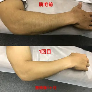 メンズ Beauty K's【ビューティーケイズ】所属・メンズ脱毛サロン ／金山昌弘のエステ・リラクイメージ