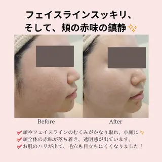 PRETTIEST SHINE所属・フェイシャル/ボディ /ブライダル山田浩子のエステ・リラクイメージ