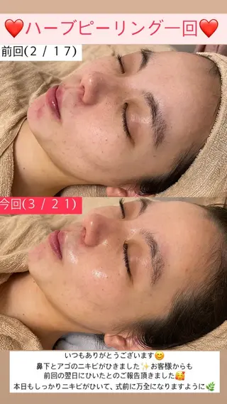 Salon de Lino 御器所のエステ・リラクイメージ