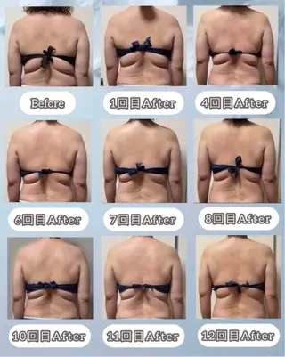 ヴィーナス ビューティーのエステ・リラクイメージ