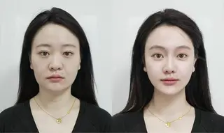 カラー aliaハイフ&水光ジェットサロン所属・aliaハーブ水光店 エステティシャン募集のエステ・リラクイメージ