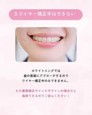 セルフホワイトニング エクシア大曽根店のその他イメージ