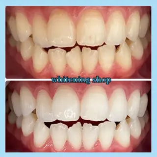 ホワイトニング ショップ千葉店のその他イメージ