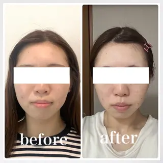 小顔と ヘッドスパのお店のエステ・リラクイメージ