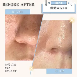 美白/韓国肌管理 💎 KOTOMIのエステ・リラクイメージ