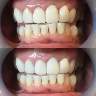 LBSホワイトニング 新宿店💝店長熊倉のエステ・リラクイメージ