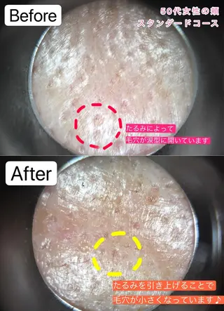 NORRA ノオラのエステ・リラクイメージ