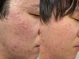 メンズ private salon Aola所属・プライベートサロン アオラのネイルデザイン