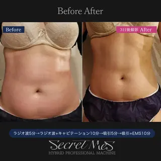 Bellvie beauty salon所属・Bellvie かすみのエステ・リラクイメージ