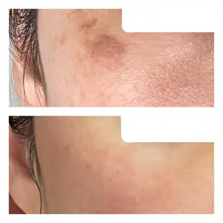 TIERRA(ティエラ)所属・TIERRA ♡のエステ・リラクイメージ