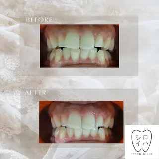 ホワイトニングサロン シロイハ所属・歯を白くしたい方🦷 シロイハのその他イメージ