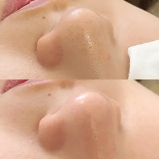 まつげ、毛穴 TREEのエステ・リラクイメージ