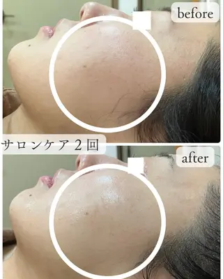 老廃物流し屋 沼倉のエステ・リラクイメージ