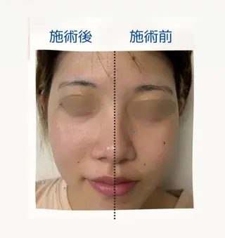 ナリスビューティサロン　デアイム津田沼所属・堀井 敏子のエステ・リラクイメージ