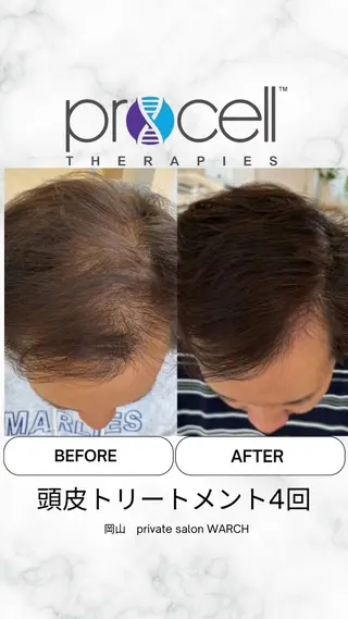 WARCH Marieのその他イメージ