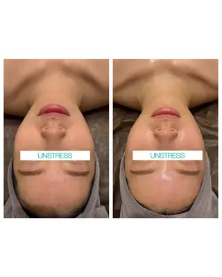 ☆痩身/小顔☆ ハイパーナイフexのエステ・リラクイメージ