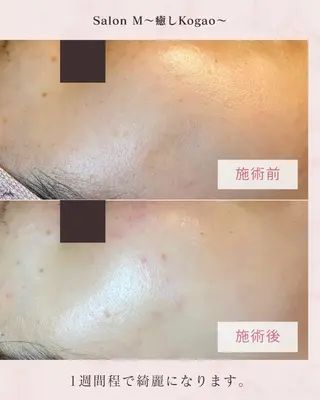 シミケア Salon Mのエステ・リラクイメージ