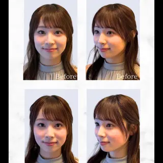 渋谷 小顔美容鍼 専門サロン YZのエステ・リラクイメージ