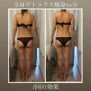 Beautysalon YURA所属・リンパ＆小顔美肌 YURA/Ayakaのエステ・リラクイメージ