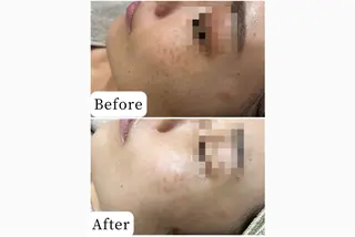 脱毛&フェイシャル 専門店muro.のエステ・リラクイメージ