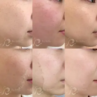 メンズ The 2Swans フェイシャル サロンのエステ・リラクイメージ