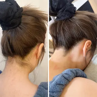 うなじ脱毛/美肌脱毛 LABELのエステ・リラクイメージ