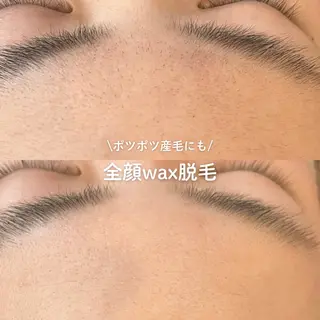 EST BEAUTY所属・顔ワックス脱毛/ ハーブピーリングのエステ・リラクイメージ