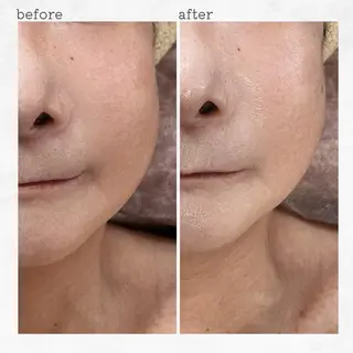 眉とお肌の専門サロン RioL / Aiのエステ・リラクイメージ