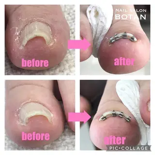 ネイル NAIL SALON BOTANのネイルデザイン