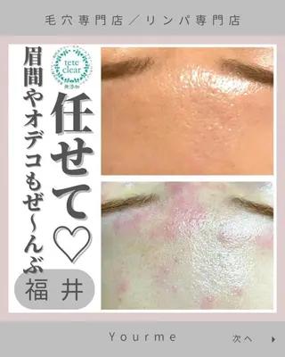 毛穴肌質ケアサロン Yourmeユアミーのエステ・リラクイメージ